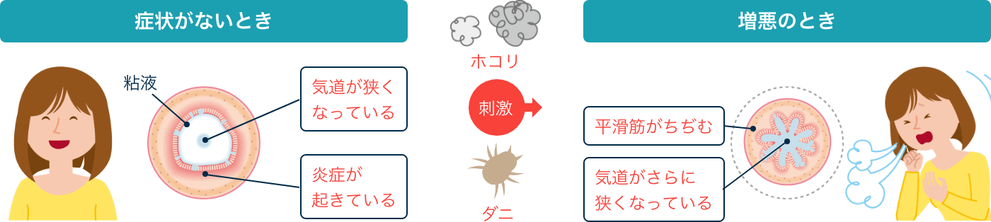 症状がないとき 増悪のとき